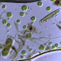 Pond bacteria under microscope